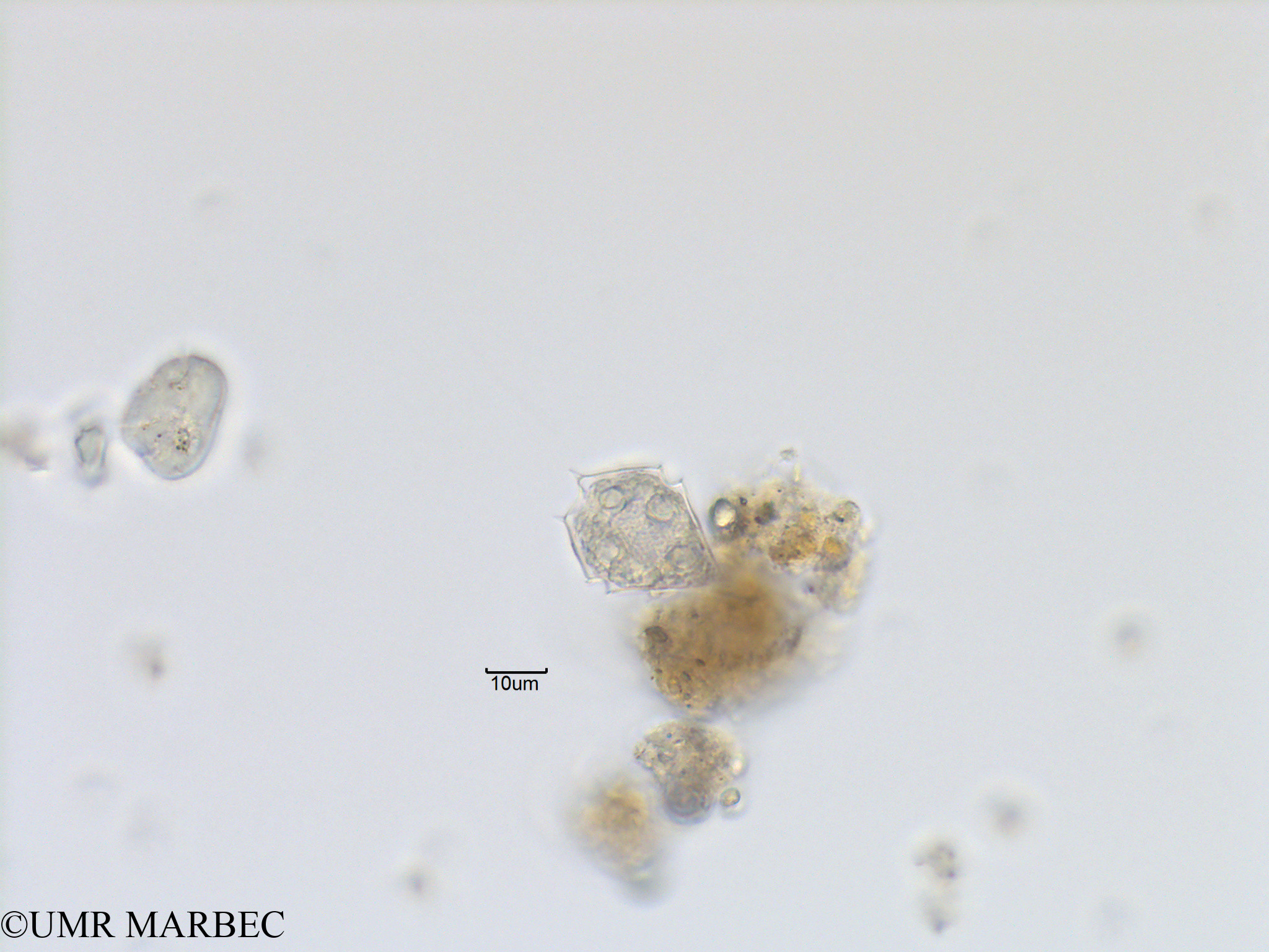 phyto/Bizerte/bizerte_lagoon/RISCO November 2015/Scrippsiella spinifera (Protoperidinium sp15-Lagune_T1_B_Dino b-1).tif(copy).jpg